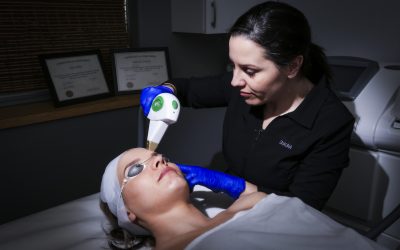 What is an IPL Photofacial?