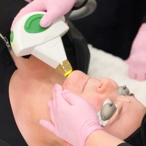 One gloved hand holding laser treatment hand device against female client's forehead, another gloved hand holding client's cheek.