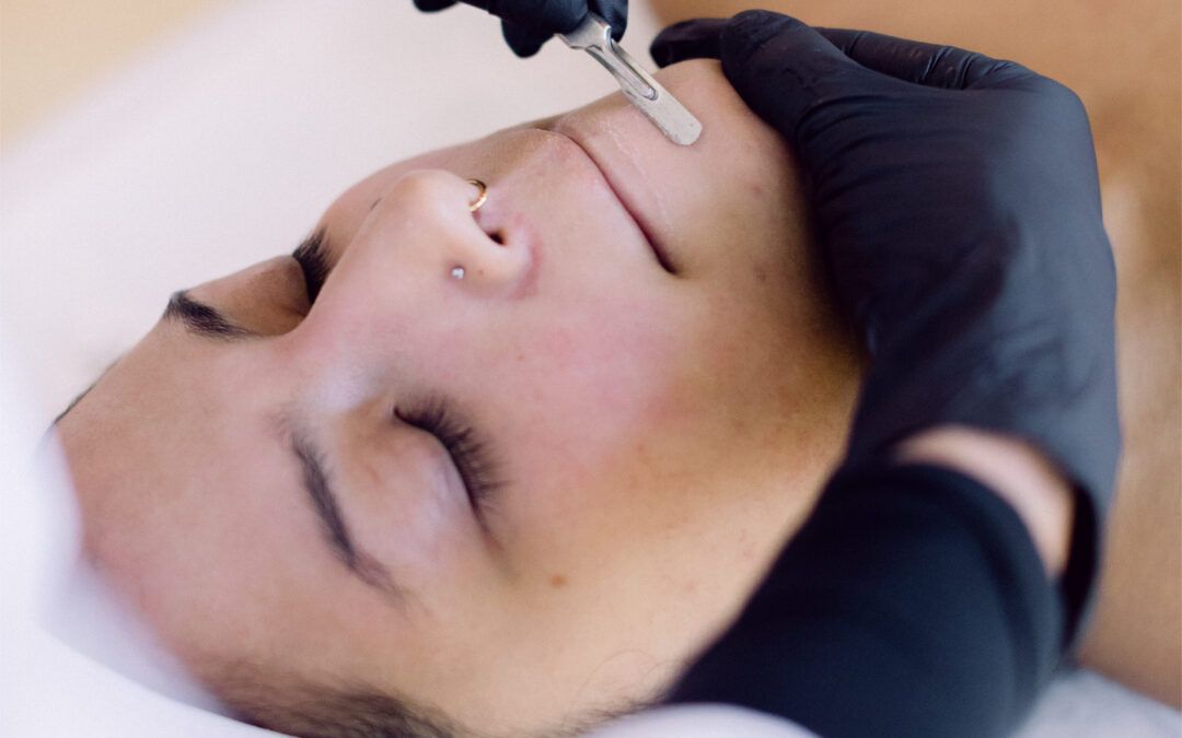 Dermaplaning training in Saskatoon, Saskatchewan