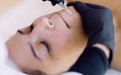 Why are my clients requesting dermaplaning?