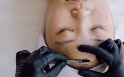 What is the Best Dermaplaning Blade?