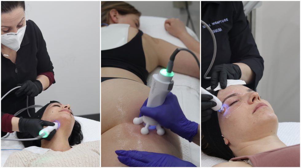 models getting RF radiofrequency for face and body