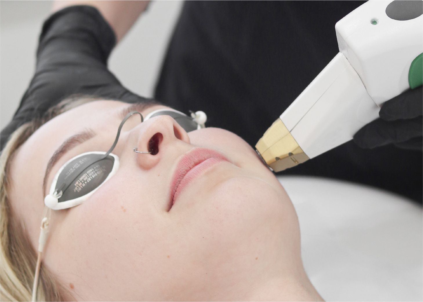 Model receiving advanced laser treamtents at Wrapture Beauty Academy