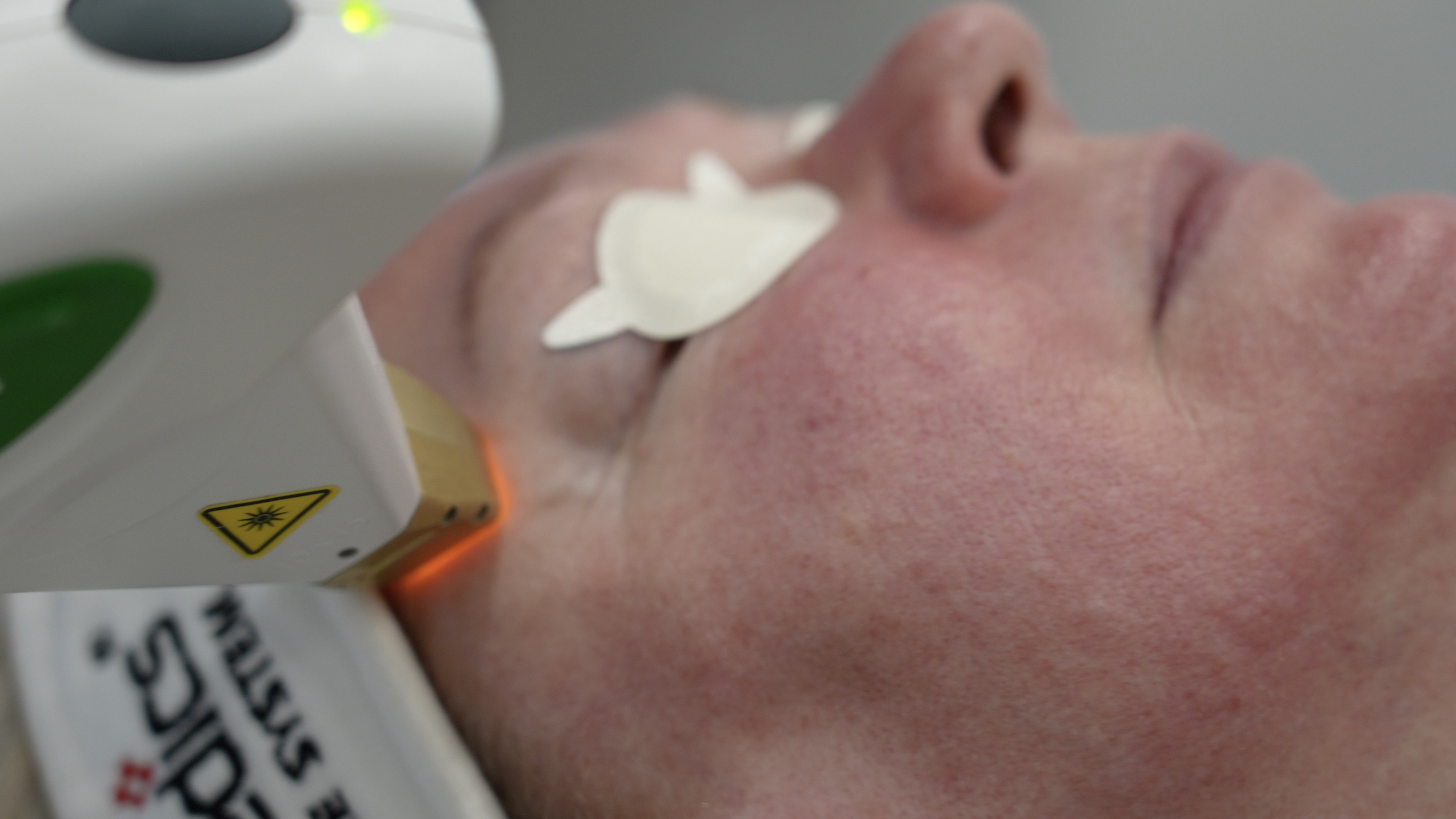 “client receiving an IPL photofacial from a student supervised by an instructor”