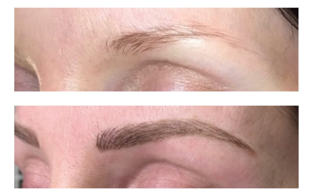 Image showing a brow before and after microblading